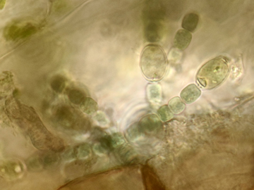 Anabaena azollae